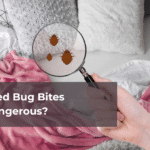 Are Bed Bug Bites Dangerous